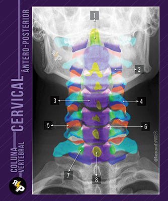 Chicletão Card - Coluna Vertebral - Raio-X Ântero Posterior de Cervical