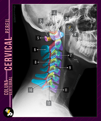 Chicletão Card - Coluna Vertebral - Raio-X Perfil de Cervical