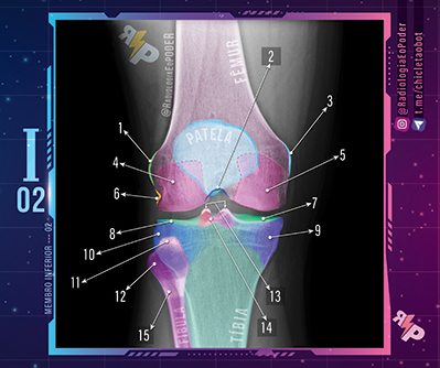 Chicletão Card - Membro Inferior 02 - Raio-X Ântero Posterior de Joelho
