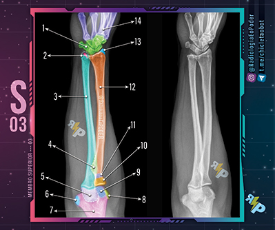 Chicletão Card - Membro Superior 03 - Raio-X Ântero Posterior de Antebraço