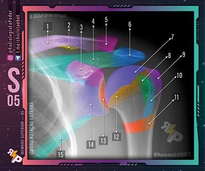 Chicletão Card - Membro Superior 05 - Raio-X Ântero Posterior de Ombro em Rotação Externa