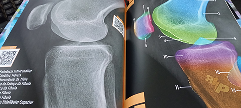 Foto do livro Anatomia Radiografica no capitulo de Joelho Perfil