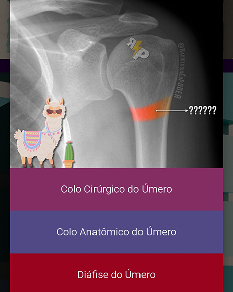 Quiz para treinar memorização, com 3 opções de resposta e lista final com o resultado das estruturas anatômicas que você deve caprichar mais nos estudos.